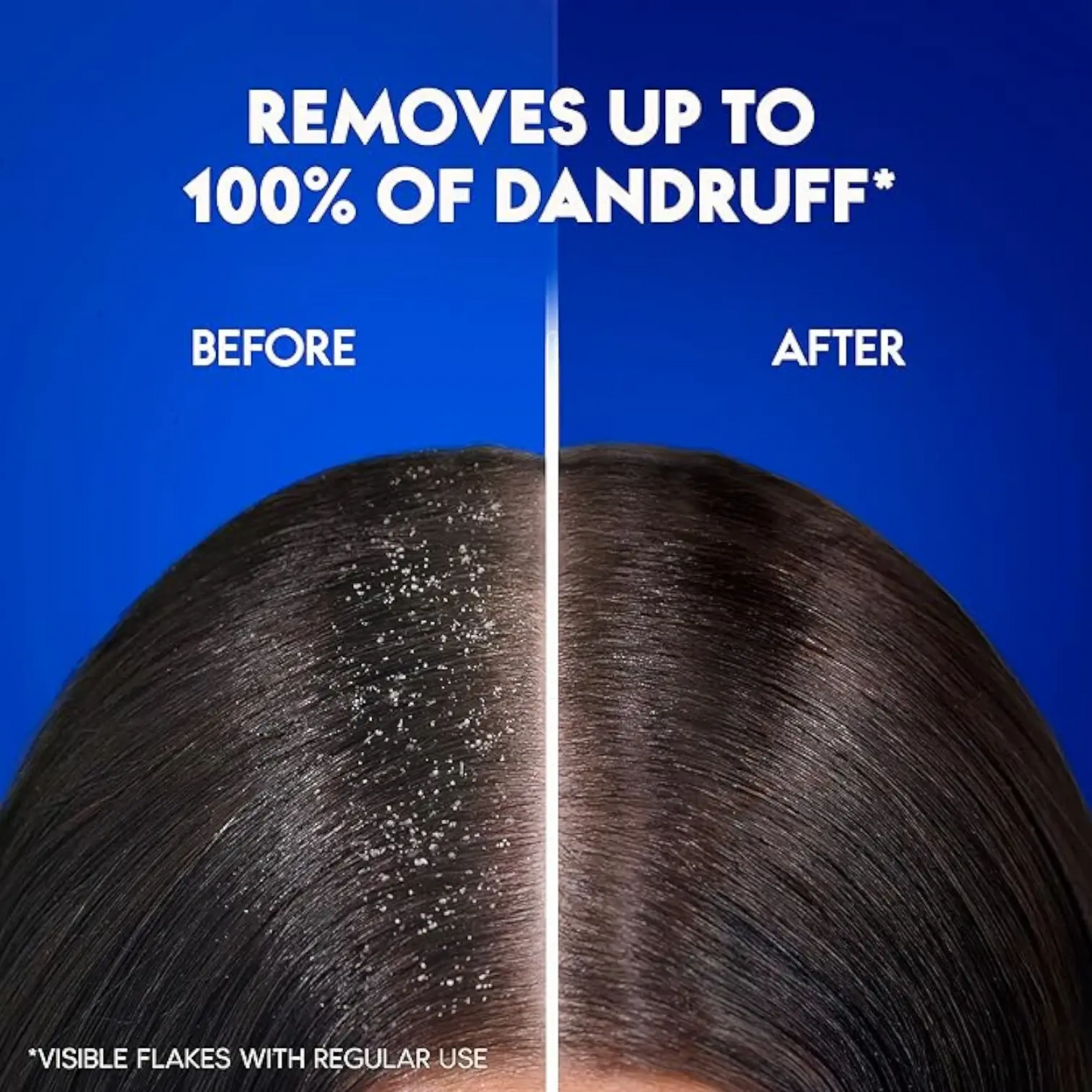 Anti Dandruff Shampoo - Sulphate Free (200ml)