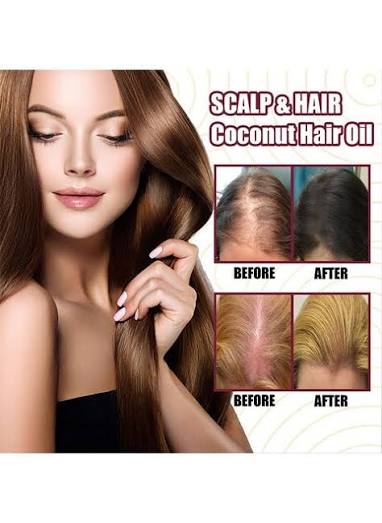 Coconut Oil - 100% Cold Pressed