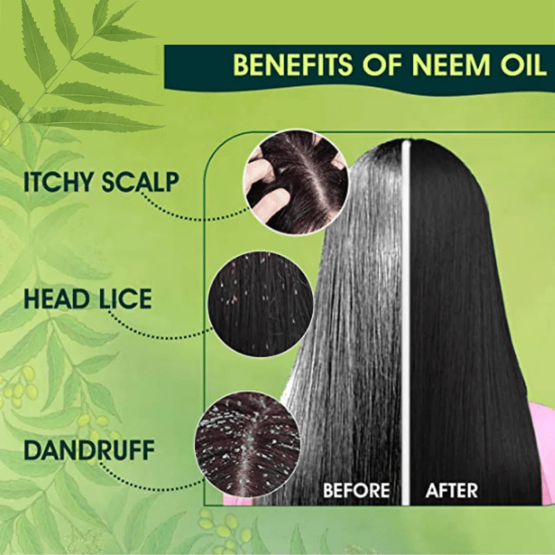 Neem Oil (60ml) - 100% Organic
