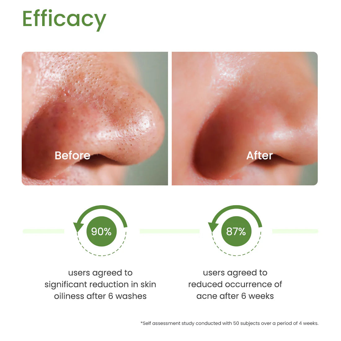 Oil Control Facewash (100ml) - 100% Organic